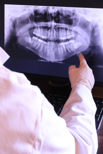 Best Emergency Treatment for Oral Infections in Anderson, MO