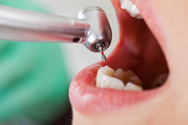 Best Walk-In Emergency Dental Services in Anderson, MO